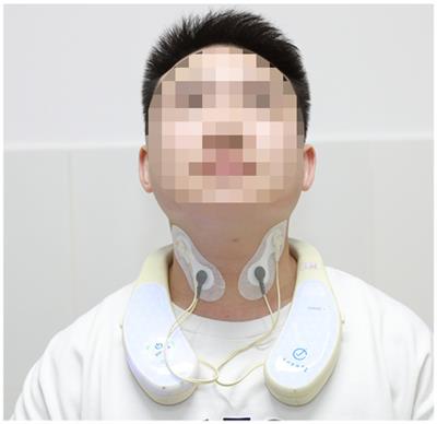 Transcutaneous cervical vagus nerve stimulation improved motor cortex excitability in healthy adults: a randomized, single-blind, self-crossover design study